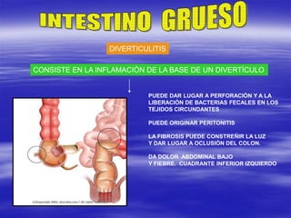 DIVERTICULITIS
CONSISTE EN LA INFLAMACIÒN DE LA BASE DE UN DIVERTÌCULO
PUEDE DAR LUGAR A PERFORACIÒN Y A LA
LIBERACIÒN DE BACTERIAS FECALES EN LOS
TEJIDOS CIRCUNDANTES
PUEDE ORIGINAR PERITONITIS
LA FIBROSIS PUEDE CONSTREÑIR LA LUZ
Y DAR LUGAR A OCLUSIÒN DEL COLON.
DA DOLOR ABDOMINAL BAJO
Y FIEBRE. CUADRANTE INFERIOR IZQUIERDO
 