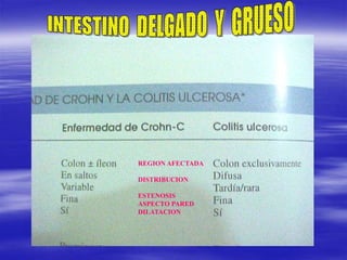 REGION AFECTADA
DISTRIBUCION
ESTENOSIS
ASPECTO PARED
DILATACION
 