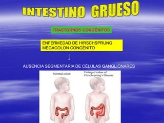 TRASTORNOS CONGÈNITOS
ENFERMEDAD DE HIRSCHSPRUNG
MEGACOLON CONGÈNITO
AUSENCIA SEGMENTARIA DE CÈLULAS GANGLIONARES
 