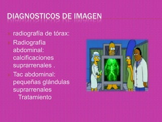 Diagnosticos de imagen radiografía de tórax:Radiografía abdominal: calcificaciones suprarrenales .Tac abdominal: pequeñas glándulas suprarrenales    Tratamiento