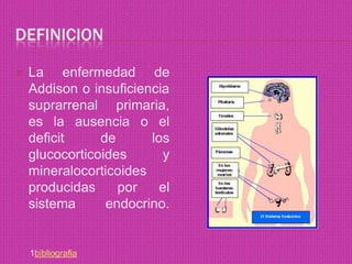 definicionLa enfermedad de Addison o insuficiencia suprarrenal primaria, es la ausencia o el deficit de los glucocorticoides y mineralocorticoides producidas por el sistema endocrino.1bibliografia