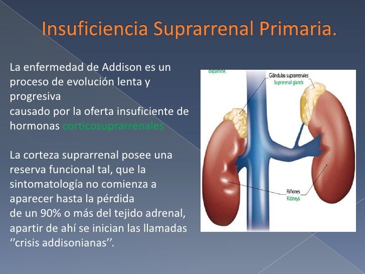 Enfermedad de addison