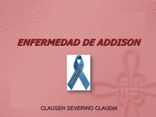 ENFERMEDAD DE ADDISON




    CLAUSEN SEVERINO CLAUDIA
 