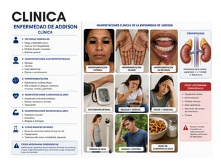 Comprehensive Overview of Addison's Disease: Diagnosis, Etiology, and ...