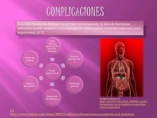  La disminución de la serotonina causan la depresión, disminución de la melatonina (La hormona que regula el sueño y fortalece el sistema inmunológico) causando pobres sueño, e infecciones frecuentes. (8.1)Imagen tomada de: http://blog.pucp.edu.pe/media/1120/20081114-cortisol_image.jpg8.1http://biblioteca.fucsalud.edu.co:2080/ehost/pdfviewer/pdfviewer?vid=5&hid=15&sid=e3769201-3a20-46ed-a0a3-323982f31c04%40sessionmgr4