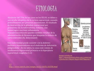 A raíz de estrés prolongado, las glándulas suprarrenales se agotan y no pueden producir suficiente cantidad de sus hormonas. El cuerpo y la  mente se vuelven débiles y vulnerables. 