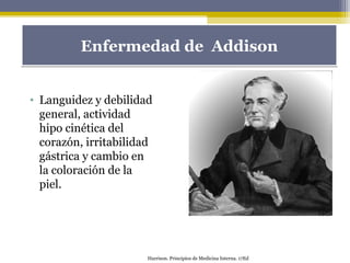 Enfermedad de AddisonEnfermedad de Addison
• Languidez y debilidad
general, actividad
hipo cinética del
corazón, irritabilidad
gástrica y cambio en
la coloración de la
piel.
Harrison. Principios de Medicina Interna. 17Ed
 