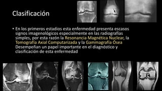 Enfermedad de Ahlback | PDF
