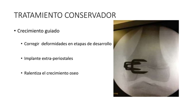 ENFERMEDAD DE BLOUNT O TIBIA VARA .pptx