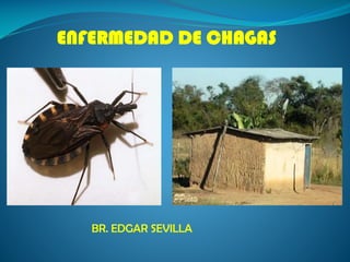 ENFERMEDAD DE CHAGAS

BR. EDGAR SEVILLA

 