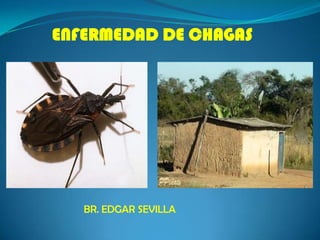 ENFERMEDAD DE CHAGAS BR. EDGAR SEVILLA  