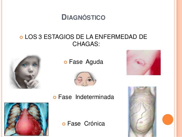 Fases De La Enfermedad De Chagas