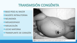 BAJO PESO AL NACER
MUERTE INTRAUTERINA
NEUMONÍA
MEGAESOFAGO
MEGACOLÓN
LECHE MATERNA
TRANSPLANTE DE CORAZÓN
 