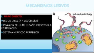 1. DAÑO DIRECTO
LESION DIRECTA A LAS CELULAS
INVASION CELULAR  DAÑO IRREVERSIBLE
EN ORGANOS
SISTEMA NERVIOSO PERIFERICO
 