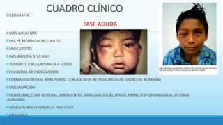 GEOGRAFIA
FASE AGUDA
MÁS VIRULENTA
SNC  MENINGOENCEFALITIS
MIOCARDITIS
INCUBACION: 3-10 DIAS
TORRENTE CIRCULATORIO 4-6 MESES
CHAGOMA DE INOCULACION
EDEMA UNILATERAL BIPALPEBRAL CON ADENITIS RETROAURICULAR (SIGNO DE ROMAÑA)
DISEMINACION
FIEBRE, MALESTAR GENERAL, LINFADENITIS, MIALGIAS, ESCALOFRIOS, HEPATOESPLENOMEGALIA, ASTENIA
ADINAMIA
DESEQUILIBRIO HIDROELECTROLITICO
ANASARCA
 