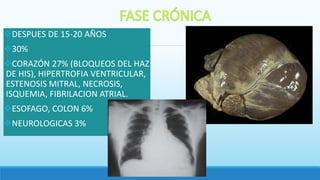 DESPUES DE 15-20 AÑOS
30%
CORAZÓN 27% (BLOQUEOS DEL HAZ
DE HIS), HIPERTROFIA VENTRICULAR,
ESTENOSIS MITRAL, NECROSIS,
ISQUEMIA, FIBRILACION ATRIAL.
ESOFAGO, COLON 6%
NEUROLOGICAS 3%
 