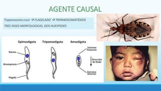 Trypanosoma cruzi  FLAGELADO  TRIPANOSOMATÍDEOS
TRES FASES MORFOLOGICAS, DOS HUESPEDES
 
