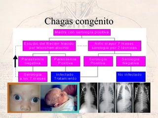 Chagas congénitoChagas congénito
 