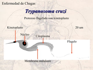 Enfermedad de Chagas
Trypanosoma cruziTrypanosoma cruzi
Protozoo flagelado con kinetoplasto
Núcleo
Flagelo
Kinetoplasto
Membrana ondulante
Citoplasma
20 um
 