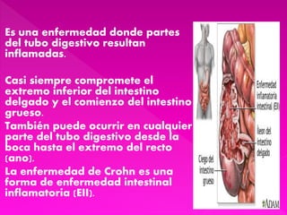 Es una enfermedad donde partes
del tubo digestivo resultan
inflamadas.
Casi siempre compromete el
extremo inferior del intestino
delgado y el comienzo del intestino
grueso.
También puede ocurrir en cualquier
parte del tubo digestivo desde la
boca hasta el extremo del recto
(ano).
La enfermedad de Crohn es una
forma de enfermedad intestinal
inflamatoria (EII).
 
