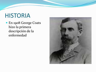 Enfermedad de coats | PPTX