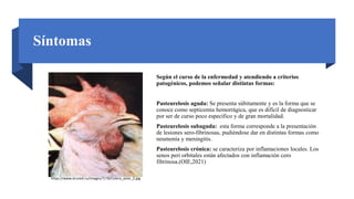 Síntomas
Según el curso de la enfermedad y atendiendo a criterios
patogénicos, podemos señalar distintas formas:
Pasteurelosis aguda: Se presenta súbitamente y es la forma que se
conoce como septicemia hemorrágica, que es difícil de diagnosticar
por ser de curso poco específico y de gran mortalidad.
Pasteurelosis subaguda: esta forma corresponde a la presentación
de lesiones sero-fibrinosas, pudiéndose dar en distintas formas como
neumonía y meningitis.
Pasteurelosis crónica: se caracteriza por inflamaciones locales. Los
senos peri orbitales están afectados con inflamación cero
fibrinosa.(OIE,2021)
https://www.ecured.cu/images/7/78/Colera_aviar_2.jpg
 