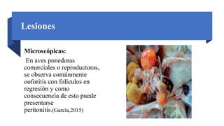 Lesiones
Microscópicas:
En aves ponedoras
comerciales o reproductoras,
se observa comúnmente
ooforitis con folículos en
regresión y como
consecuencia de esto puede
presentarse
peritonitis.(García,2015)
 