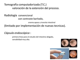 Tomografía computadorizada (T.C.)
     valoración de la extensión del proceso.

Radiología convencional
             con contraste baritado,
                          enema opaco y transito intestinal
(limitado por implementación de nuevas tecnicas).

Cápsula endoscópica :
      primera linea para el estudio del intestino delgado,
      sensibilidad muy alta.
 