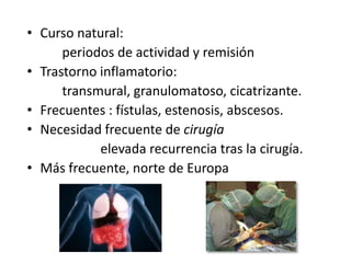• Curso natural:
      periodos de actividad y remisión
• Trastorno inflamatorio:
      transmural, granulomatoso, cicatrizante.
• Frecuentes : fístulas, estenosis, abscesos.
• Necesidad frecuente de cirugía
            elevada recurrencia tras la cirugía.
• Más frecuente, norte de Europa
 