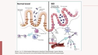 Rivas, I. (s. f.). Enfermedad inflamatoria intestinal: fisiopatología. Gastro Mérida.
https://www.ivanrivasmd.com/enfermedad-inflamatoria-intestinal-fisiopatologia/
 