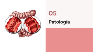 Patología
05
 