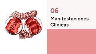 06
Manifestaciones
Clínicas
 