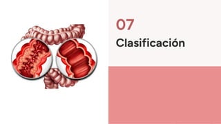 07
Clasificación
 