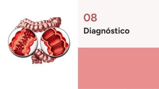 08
Diagnóstico
 