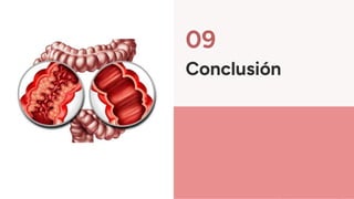 09
Conclusión
 
