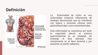 Definición
La Enfermedad de Crohn es una
enfermedad intestinal inflamatoria de
etiología desconocida que se manifiesta
con signos y síntomas clínicas tanto
gastrointestinales como extraintestinales
Esta enfermedad se caracteriza por tener
la capacidad afectar al sistema
gastrointestinal en su totalidad, sin
embargo el área afectada más
comúnmente es el íleon terminal y por
presentar un patrón saltatorio.
 