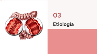 Etiología
03
 