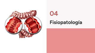 Fisiopatología
04
 