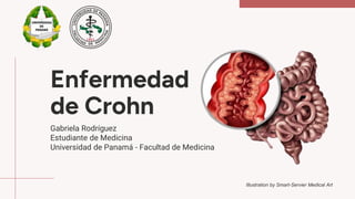 Enfermedad
de Crohn
Gabriela Rodríguez
Estudiante de Medicina
Universidad de Panamá - Facultad de Medicina
Illustration by Smart-Servier Medical Art
 