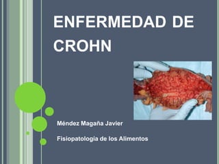ENFERMEDAD DE
CROHN

Méndez Magaña Javier
Fisiopatología de los Alimentos

 