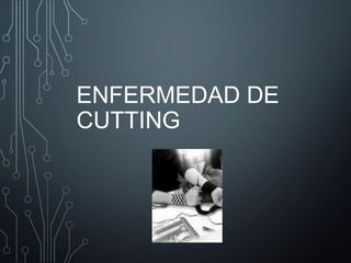 ENFERMEDAD DE 
CUTTING 
 