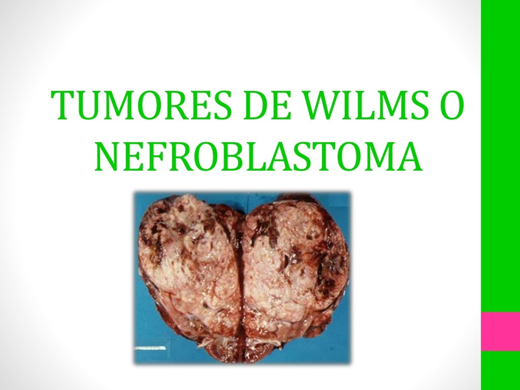 Enfermedad de fournier