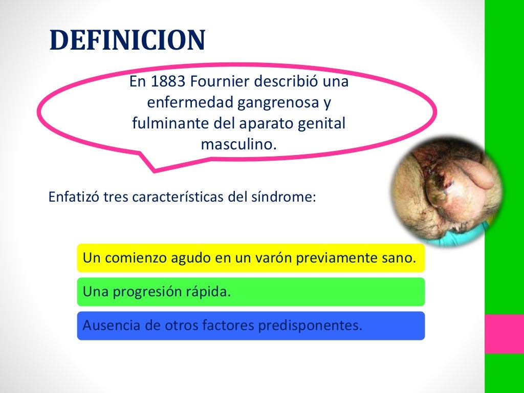 Enfermedad de fournier