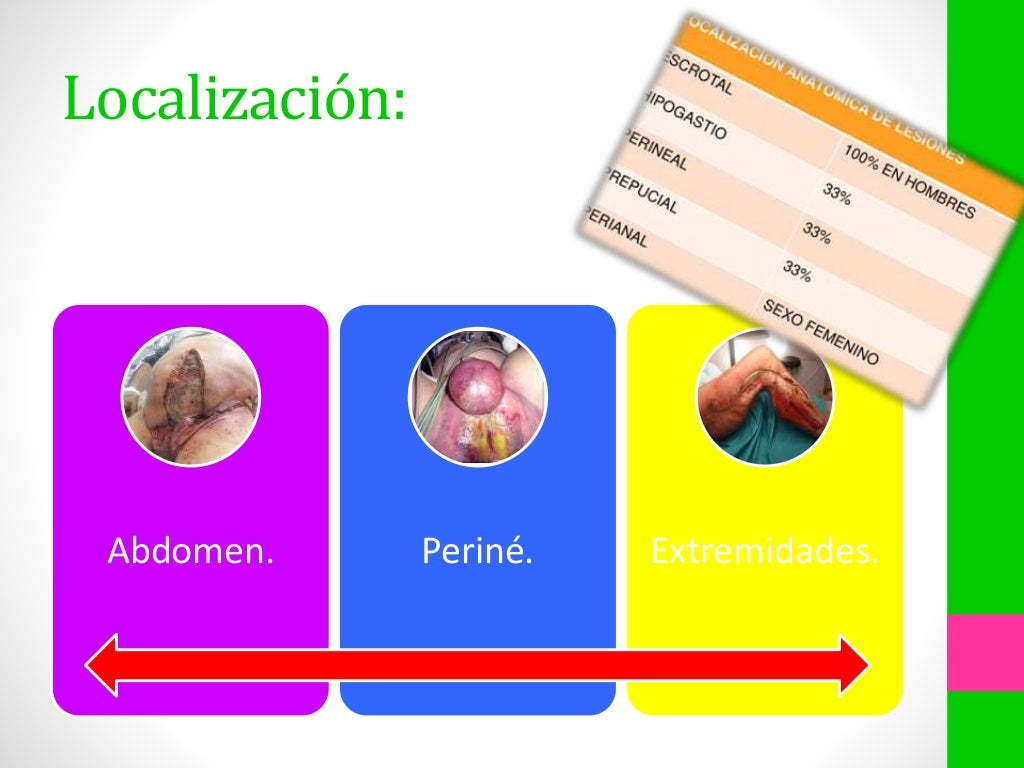 Enfermedad de fournier