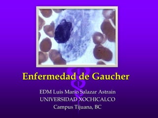 Enfermedad de Gaucher EDM Luis Mario Salazar Astrain UNIVERSIDAD XOCHICALCO Campus Tijuana, BC 