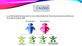 CAUSAS
• La enfermedad de Gaucher es una enfermedad de herencia Autosómica Recesiva
que afecta el gen GBA .
 