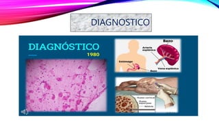 DIAGNOSTICO
 