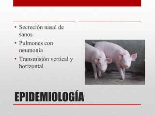 • Secreción nasal de
sanos
• Pulmones con
neumonía
• Transmisión vertical y
horizontal

EPIDEMIOLOGÍA

 