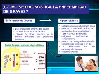 ¿CÓMO SE DIAGNOSTICA LA ENFERMEDAD
DE GRAVES?
Hipertiroidismo
 hallazgos durante el examen físico
 pruebas de laboratorio (miden la
cantidad de hormona tiroidea)-
TSH está muy disminuida.
 imágenes radioactivas, o
centellograma
 prueba de sangre-determinación
de hormonas tiroideas (T4 y T3)
 La realización de una
gammagrafia tiroidea
 ecografía tiroidea
Enfermedad de Graves
o presencia de la enfermedad ocular
o tiroides aumentada de tamaño
o historia de otros miembros de la
familia afectados por problemas
tiroideos
 