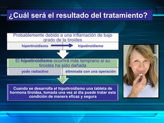 ¿Cuál será el resultado del tratamiento?
Cuando se desarrolla el hipotiroidismo una tableta de
hormona tiroidea, tomada una vez al día puede tratar esta
condición de manera eficaz y segura
El hipotiroidismo ocurrirá más temprano si su
tiroides ha sido dañada
yodo radiactivo eliminada con una operación
Probablemente debido a una inflamación de bajo
grado de la tiroides
hipertiroidismo hipotiroidismo
 